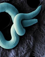 An electron microscope image of a wormlike nematode