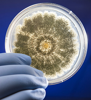 A gloved hand hovers over a round petri dish containing brownish-grey dots distributed in a circular pattern around the center of the dish.