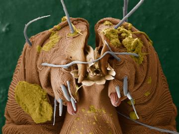 A low-temperature scanning electron microscope image of the face of a mite
